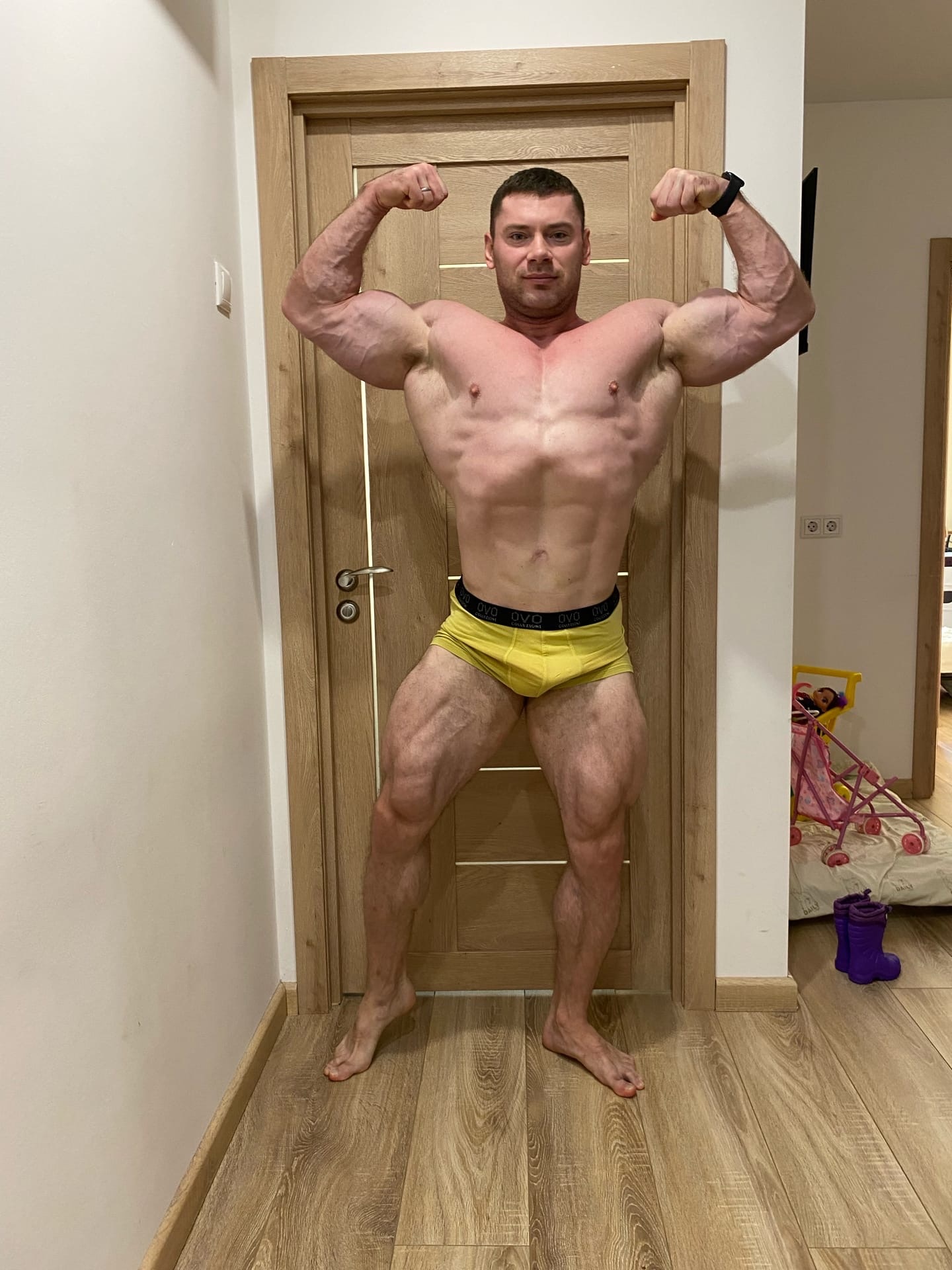 Отчет по текущей форме и проблема с коленом. - Бодибилдинг форум AnabolicShops