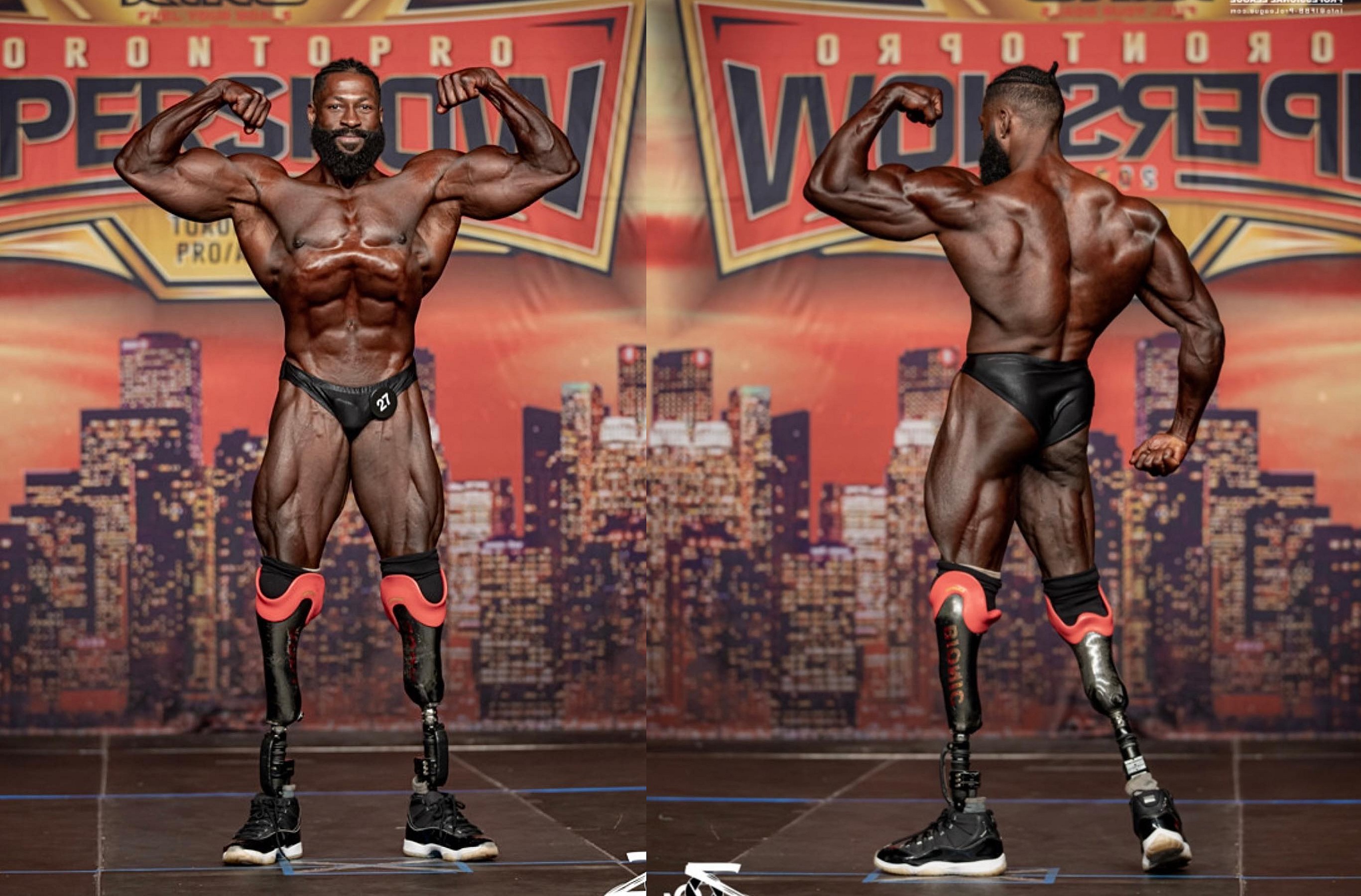 Безногий атлет ‘Bionic Body’ участвует в соревнованиях Classic Physique. Его история - Бодибилдинг форум AnabolicShops
