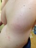 Шишки - Бодибилдинг форум AnabolicShops
