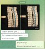 Hilma pro - Мы вернулись! и запустили Акцию! - Бодибилдинг форум AnabolicShops