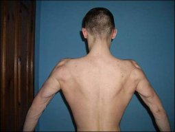 13й химик